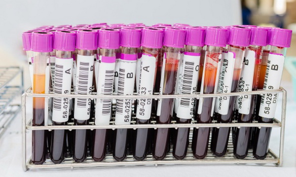 micak-4-LN.jpg 600x580